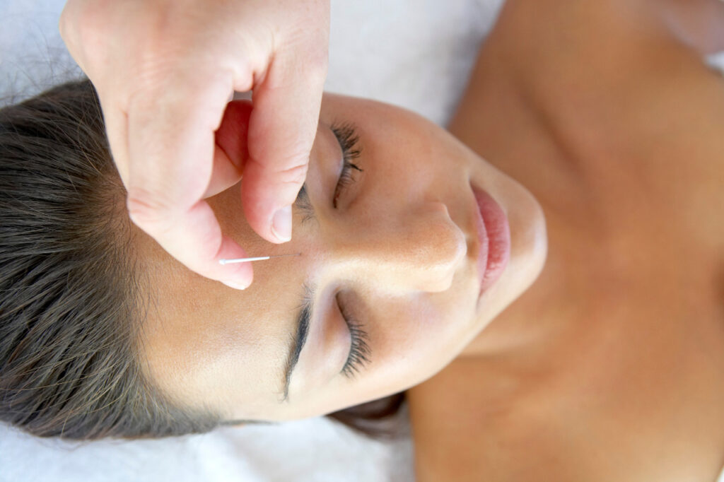 akupunktura-kosmetyczna-twarzy